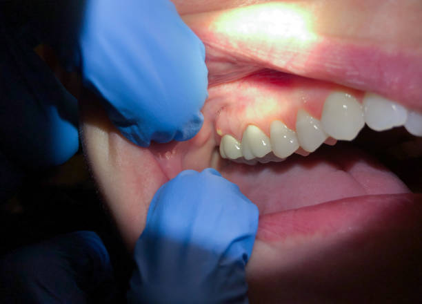 Best Emergency Gum Treatment in Cave Springs, AR